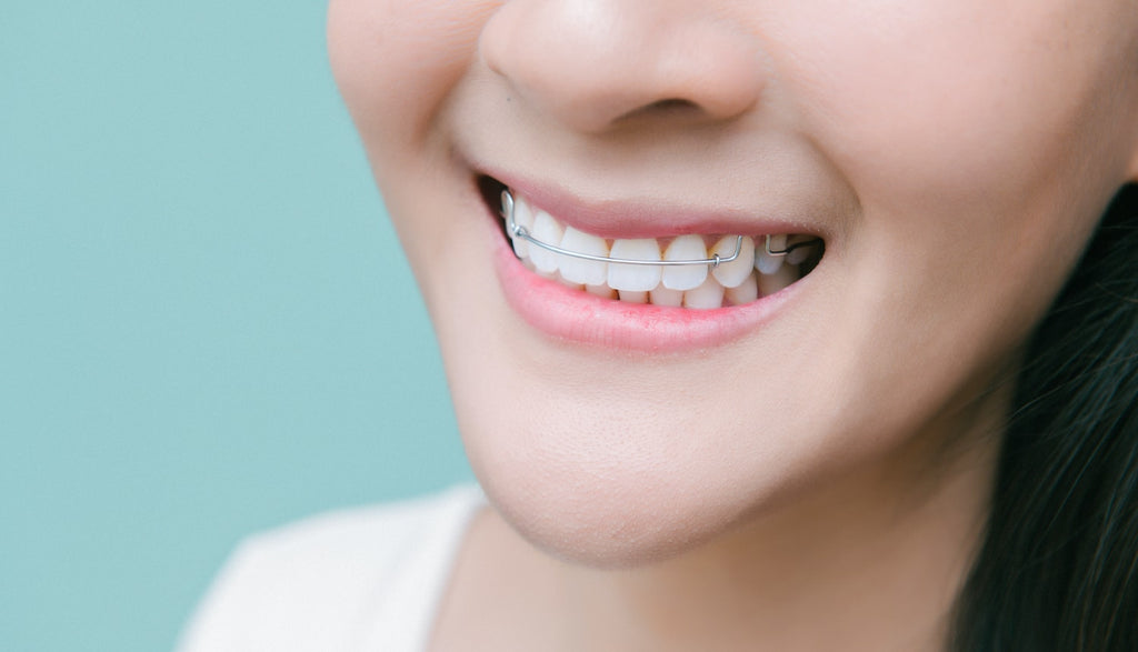 The Reality of Retainers for Kids and Teens